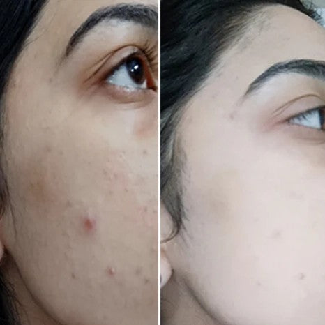 BEO Exfoliate Crystal bright Face Wash